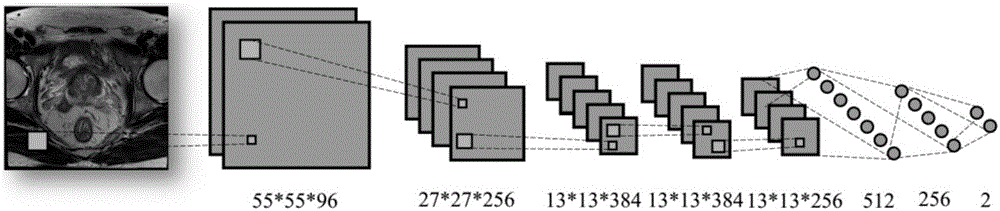 Method for focus classification of sectional medical images by employing deep learning network