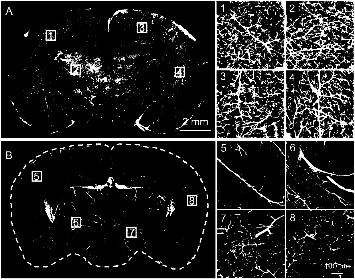 Composite nano-particle for three-dimensional fluorescence imaging of blood vessel network, and preparation method and application thereof