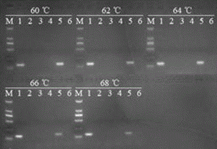 Primer group and probe capable of simultaneous quantitative determination of pratylenchus neglectus and pratylenchus thornei Sher&Allen and application thereof