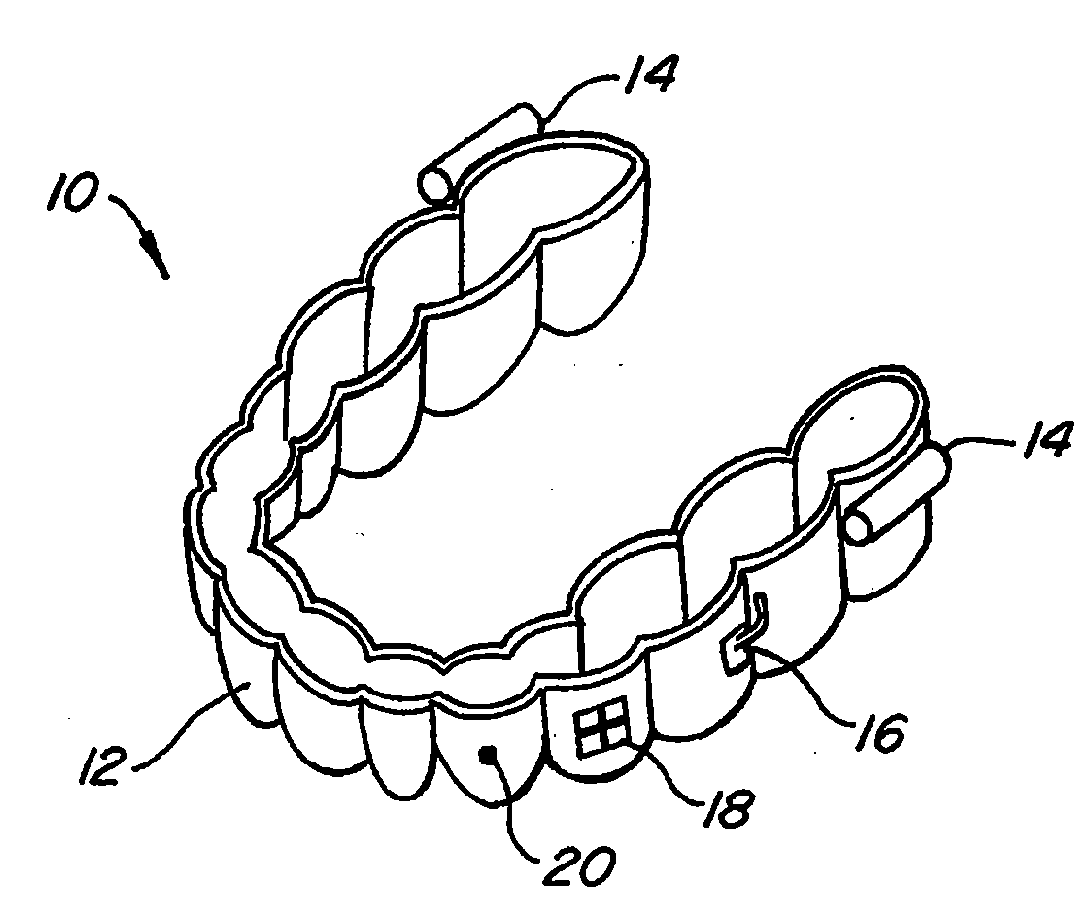 Embedded features and methods of a dental appliance