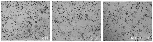 Method and medium for amplifying bone-marrow mesenchymal stem cells and application