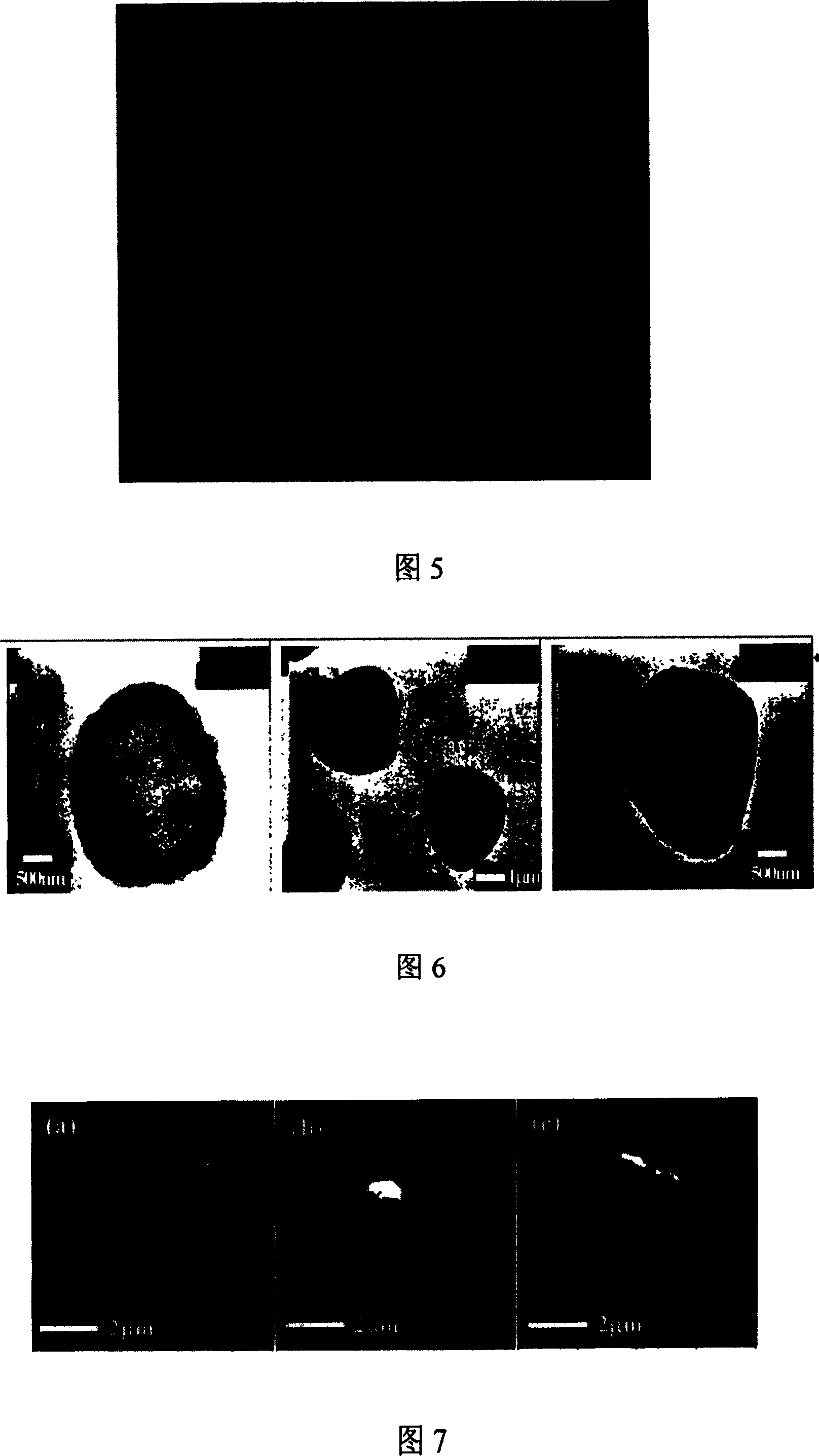 Prepn process of microcapsule with included anticancer medicine