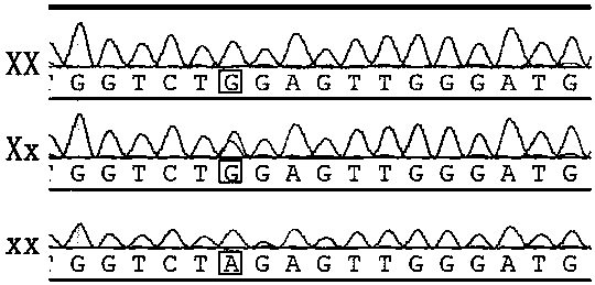 Correlation of estrogen receptor alpha gene and female ophthalmopathy occurrence time