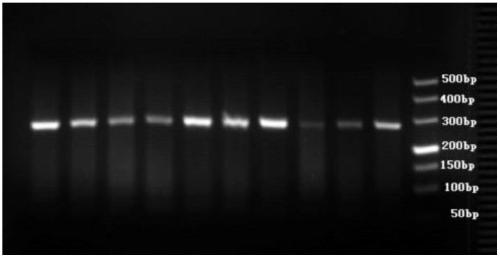 Correlation of estrogen receptor alpha gene and female ophthalmopathy occurrence time