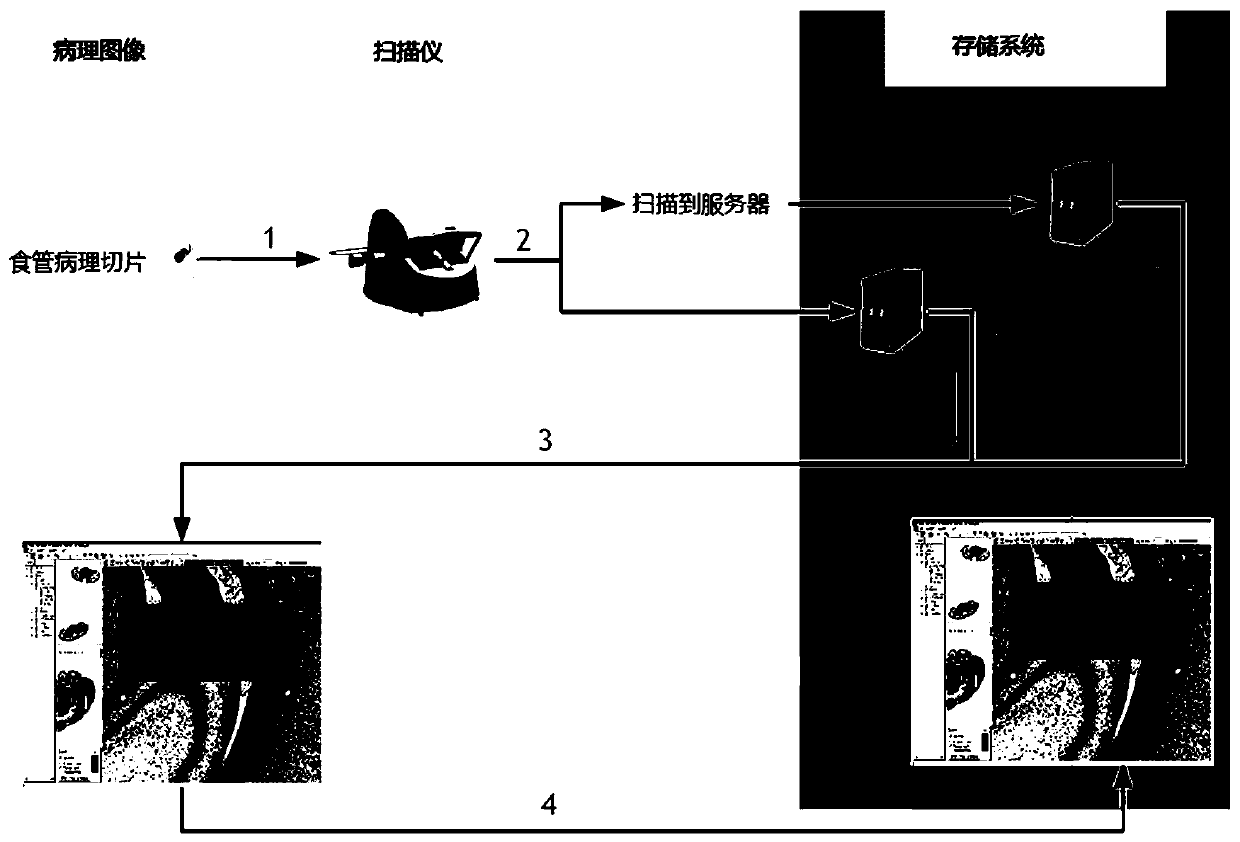 Esophageal cancer pathological image labeling method