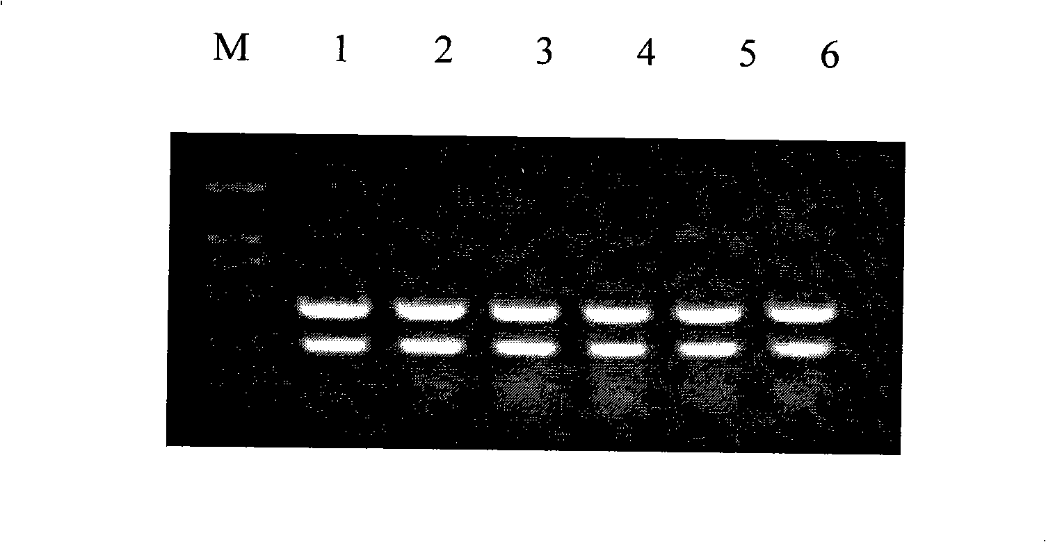 Cryptosporidium and cryptosporidium parvum specific PCR detecting reagent kit and detecting method