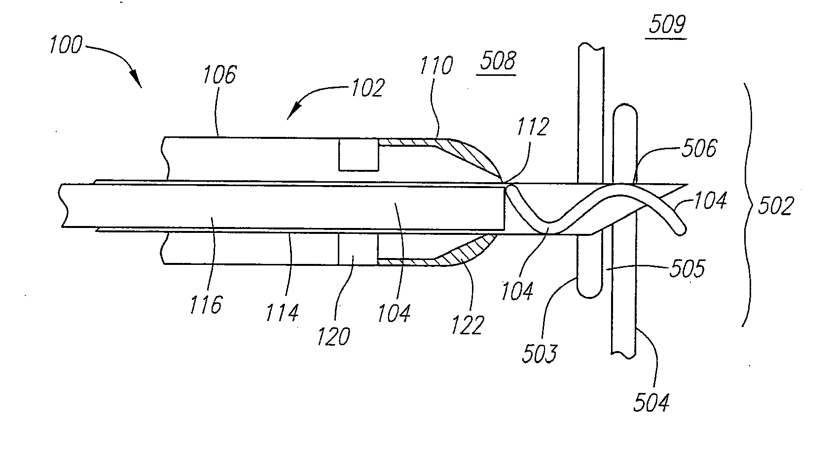 Systems and Methods for Closing Internal Tissue Defects