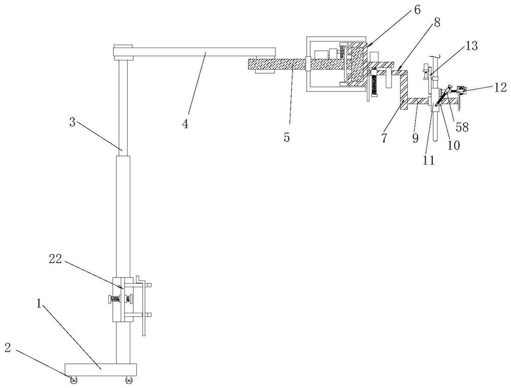 Neurosurgery critical patient sputum excretion device