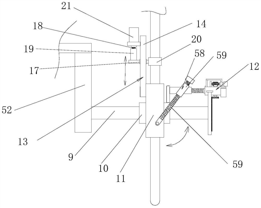 Neurosurgery critical patient sputum excretion device