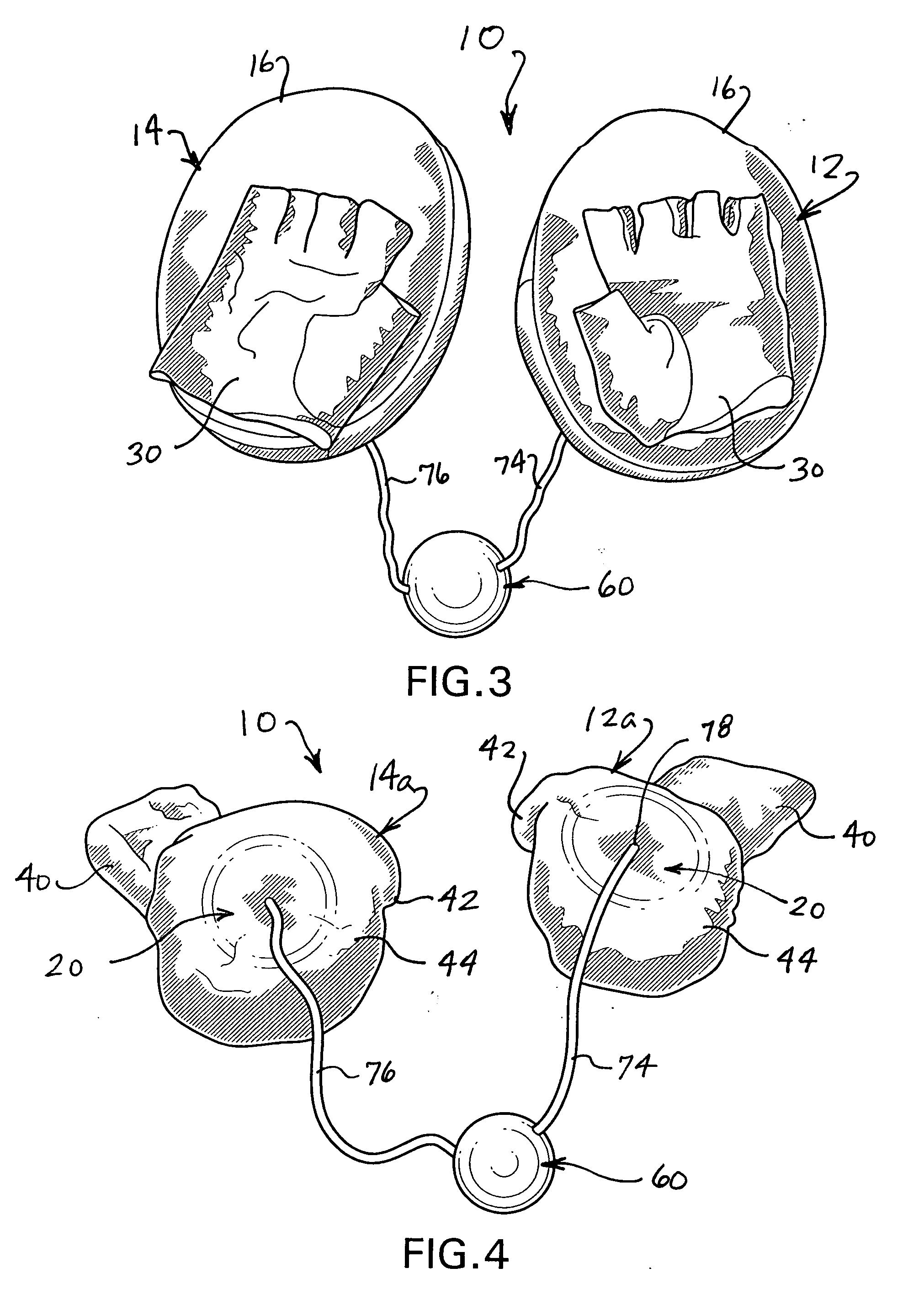 Boxing exercise device