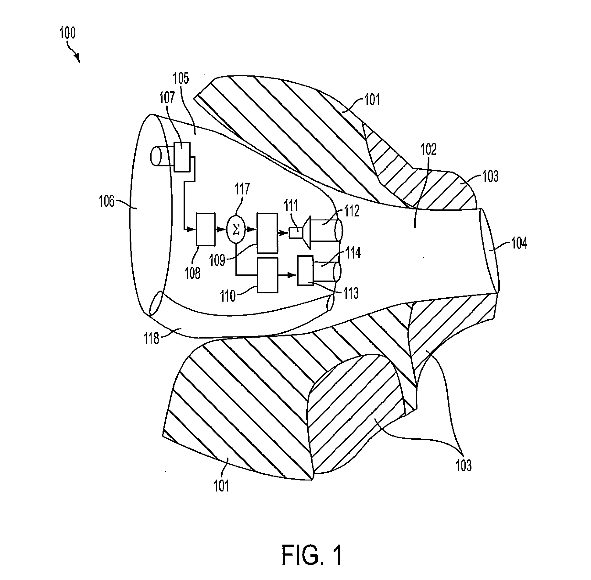 Hearing aid with occlusion reduction