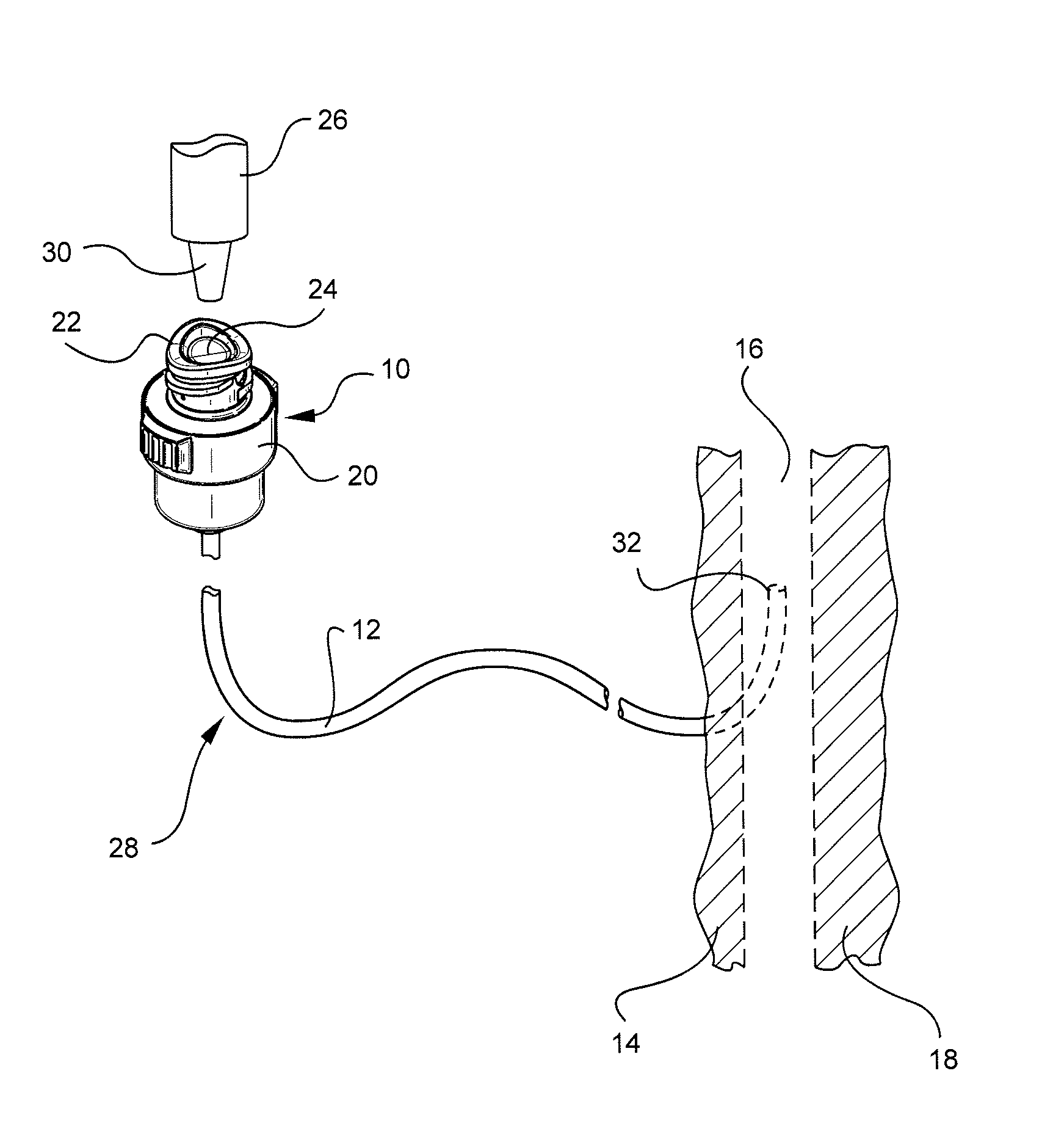 Vascular access device including a tear-resistant septum