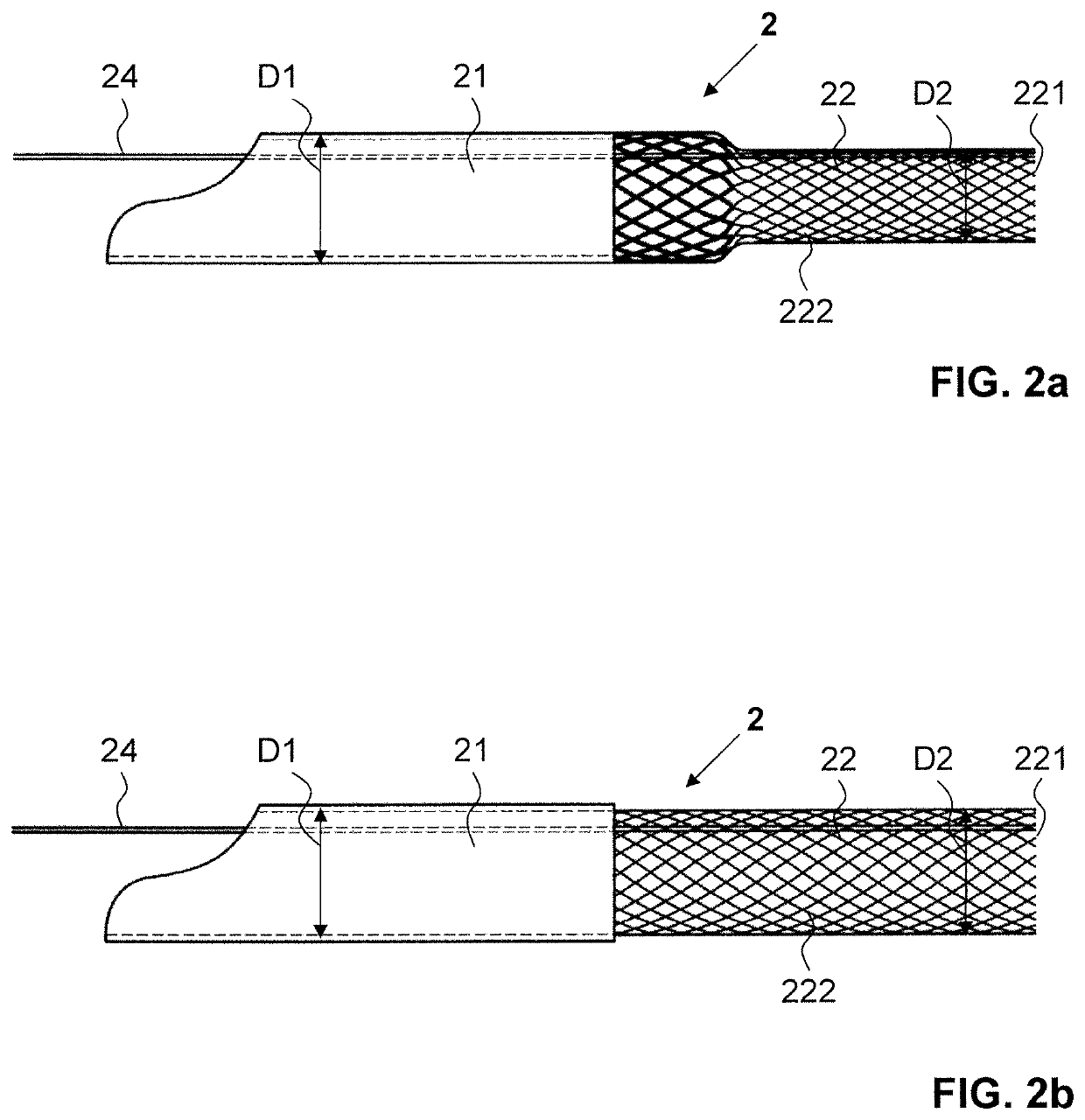 Apparatus and method for neurovascular endoluminal intervention