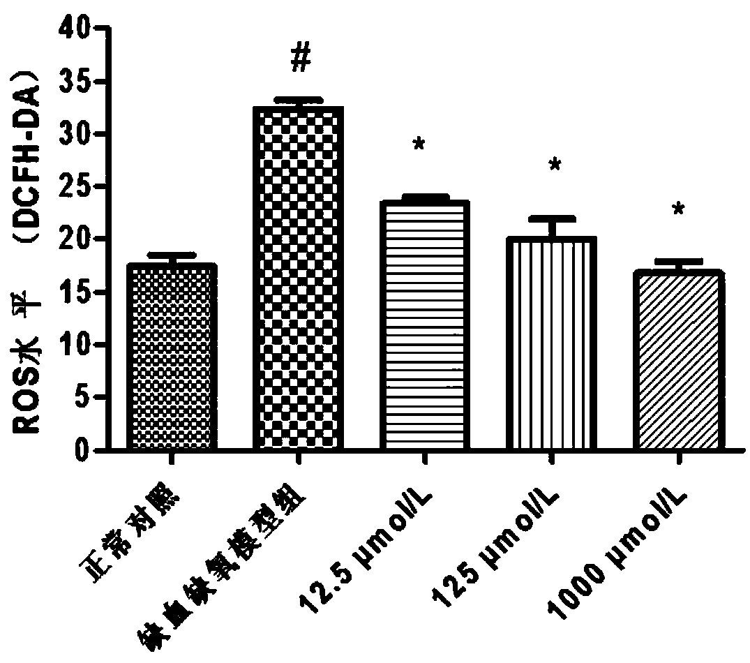 Drug for preventing and treating ischemic heart diseases, and application thereof