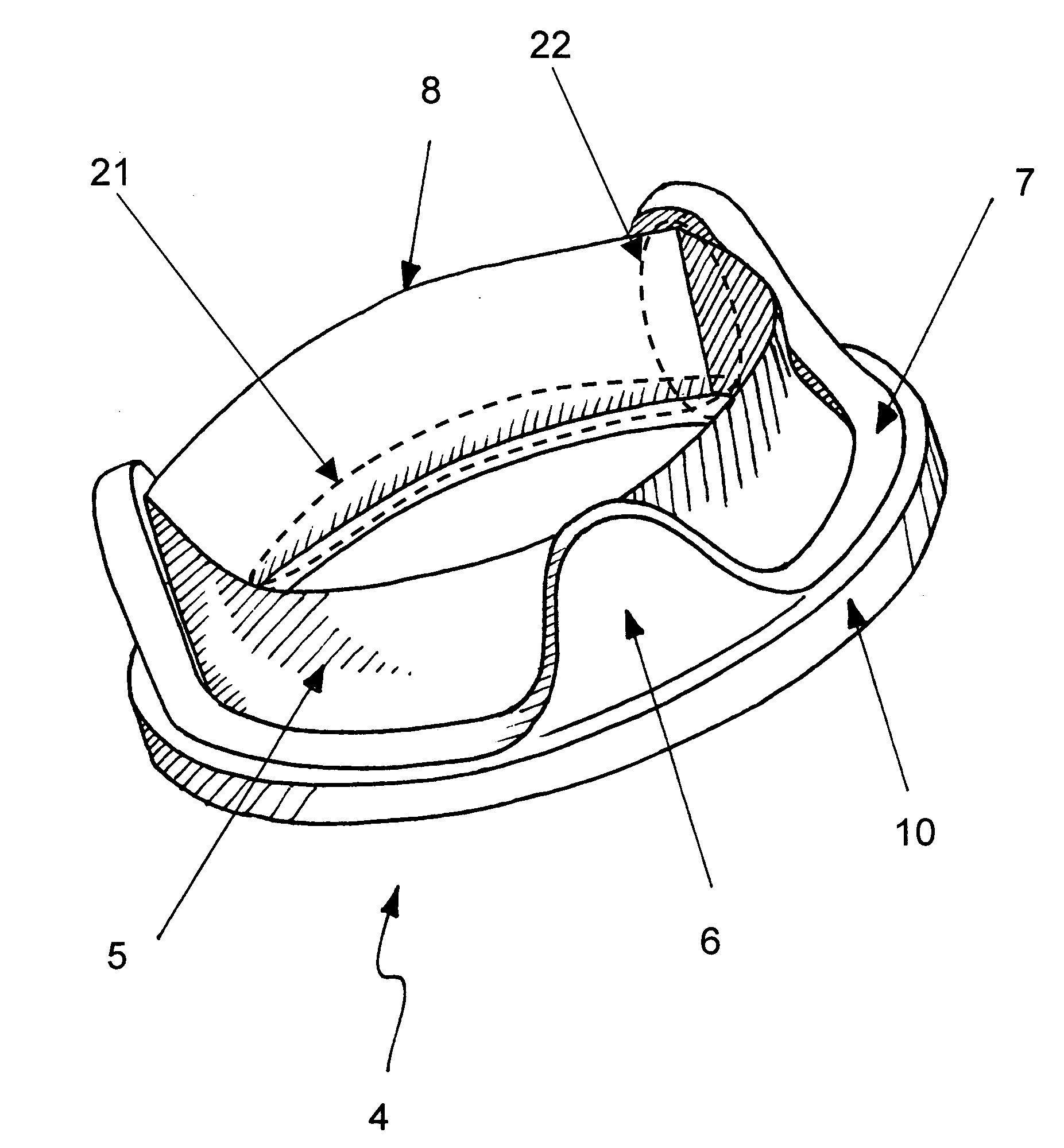 Heart valve prosthesis