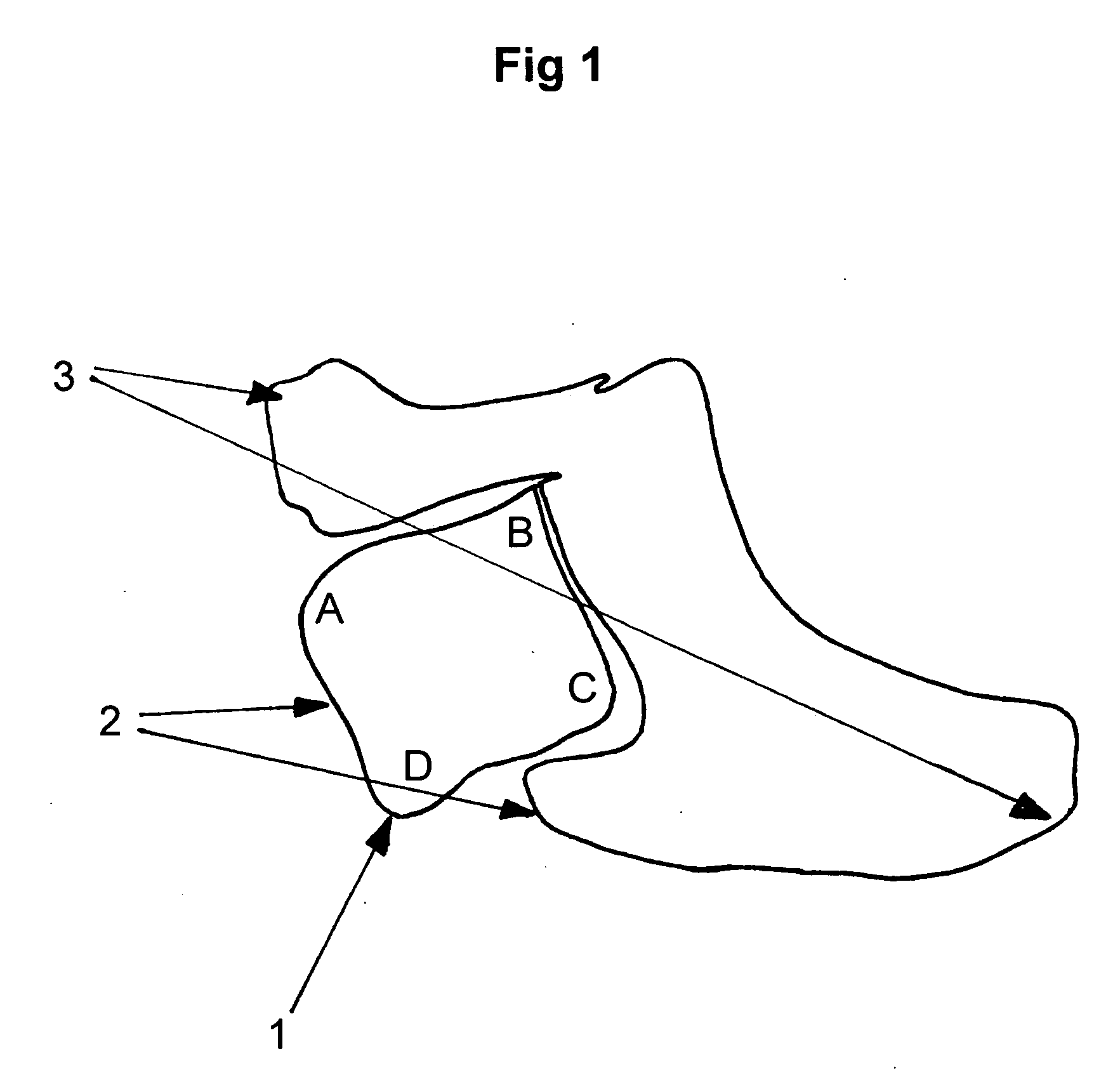 Heart valve prosthesis