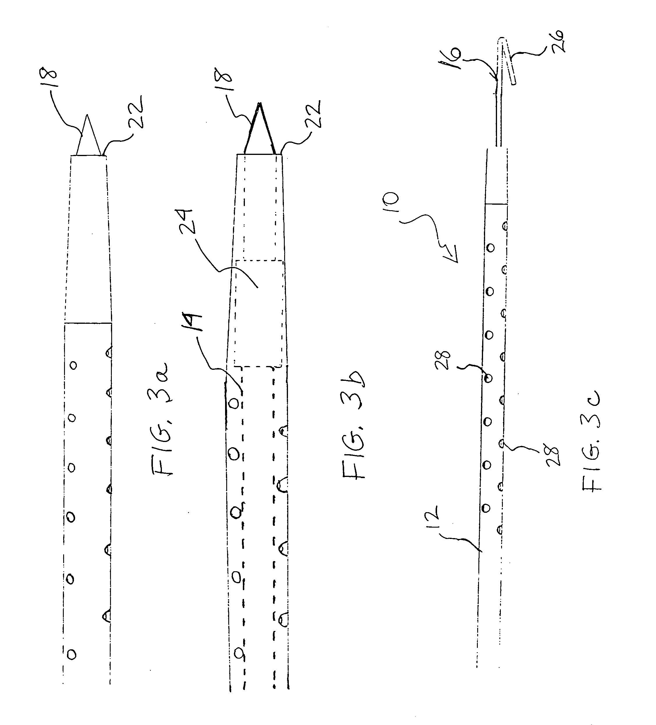 Methods and apparatus for securing medical instruments to desired locations in a patient's body