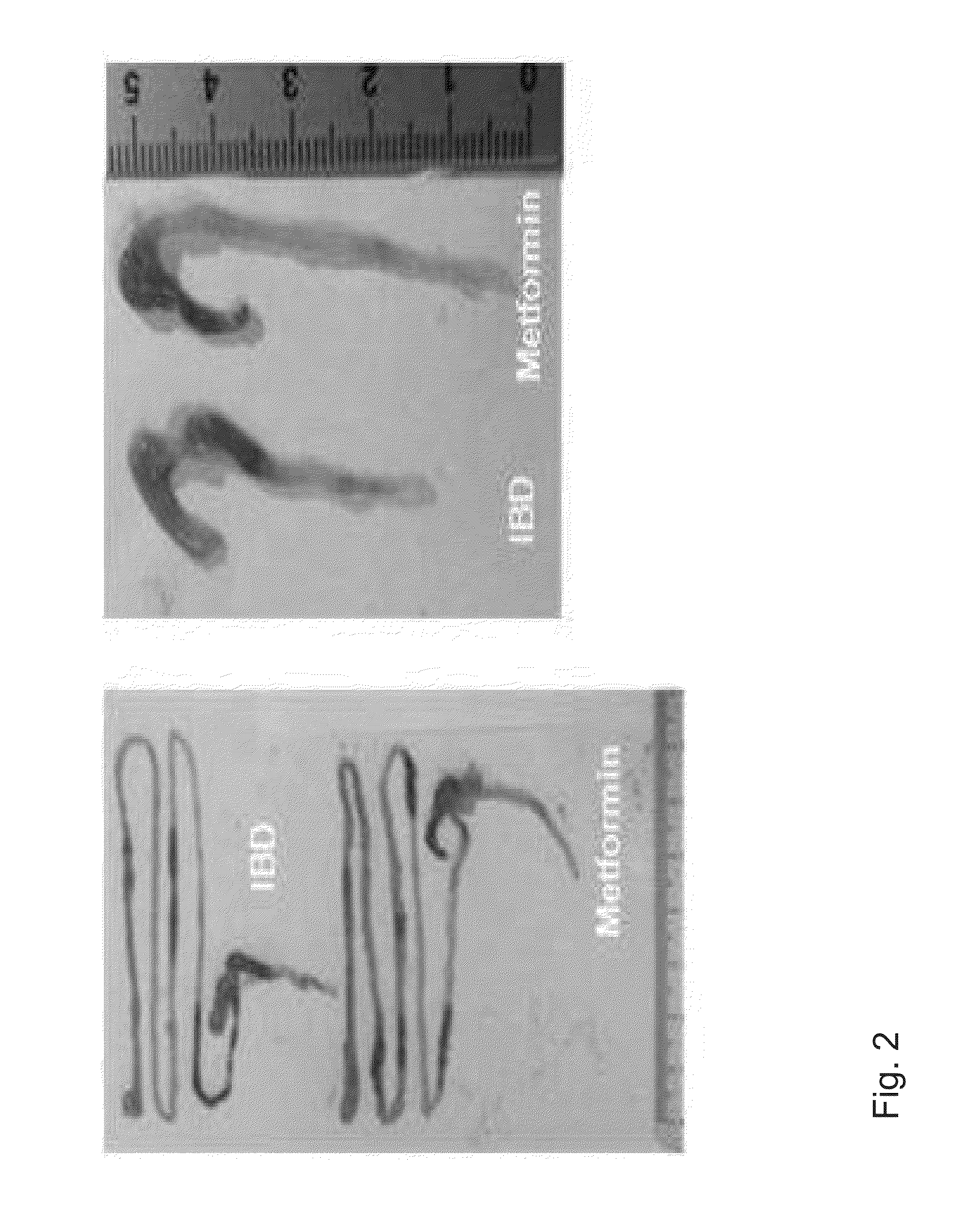 Composition comprising metformin as active ingredient for preventing or treating inflammatory bowel disease