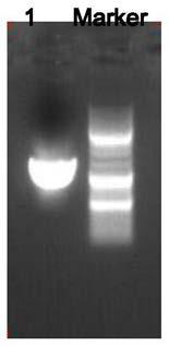 Method for quantitatively detecting iota-carrageenan by enzymatic method