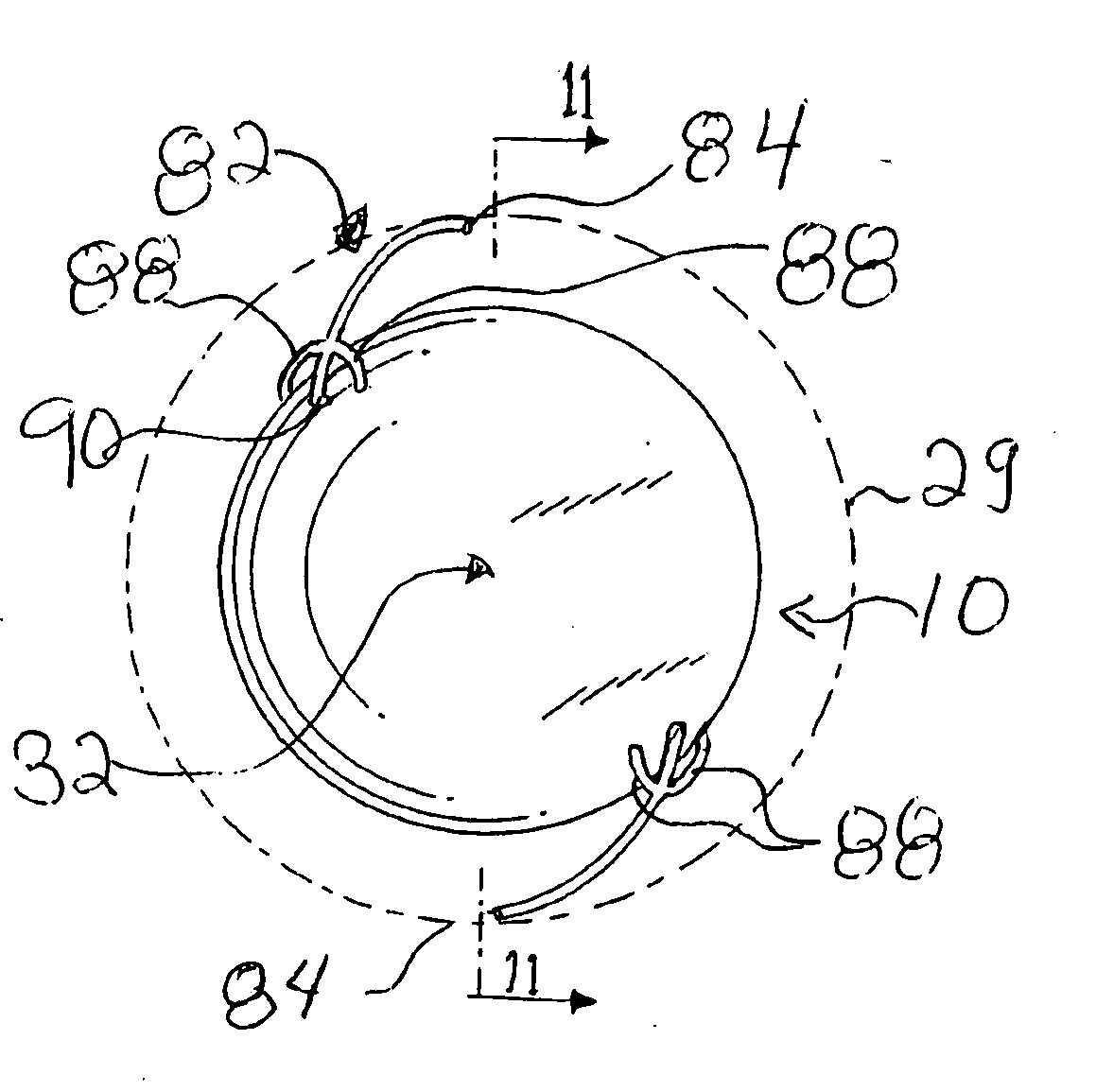 Accommodative intra-ocular lens