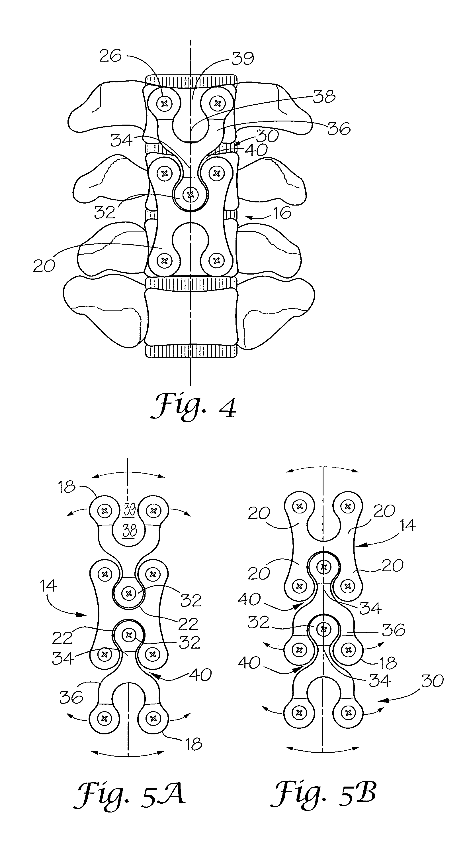 Adjacent level cervical spine plate