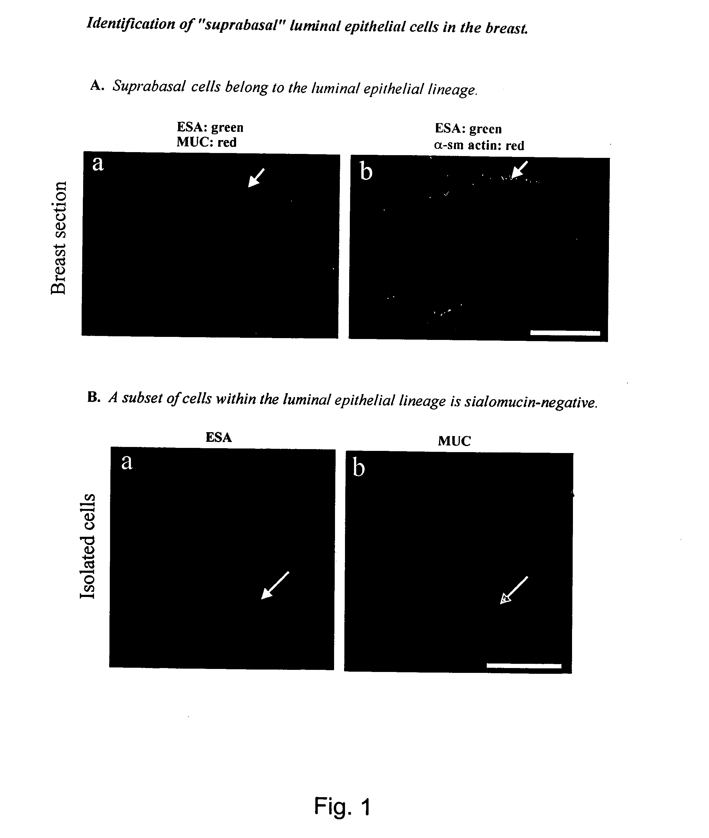 Suprabasal breast cell with stem cell properties