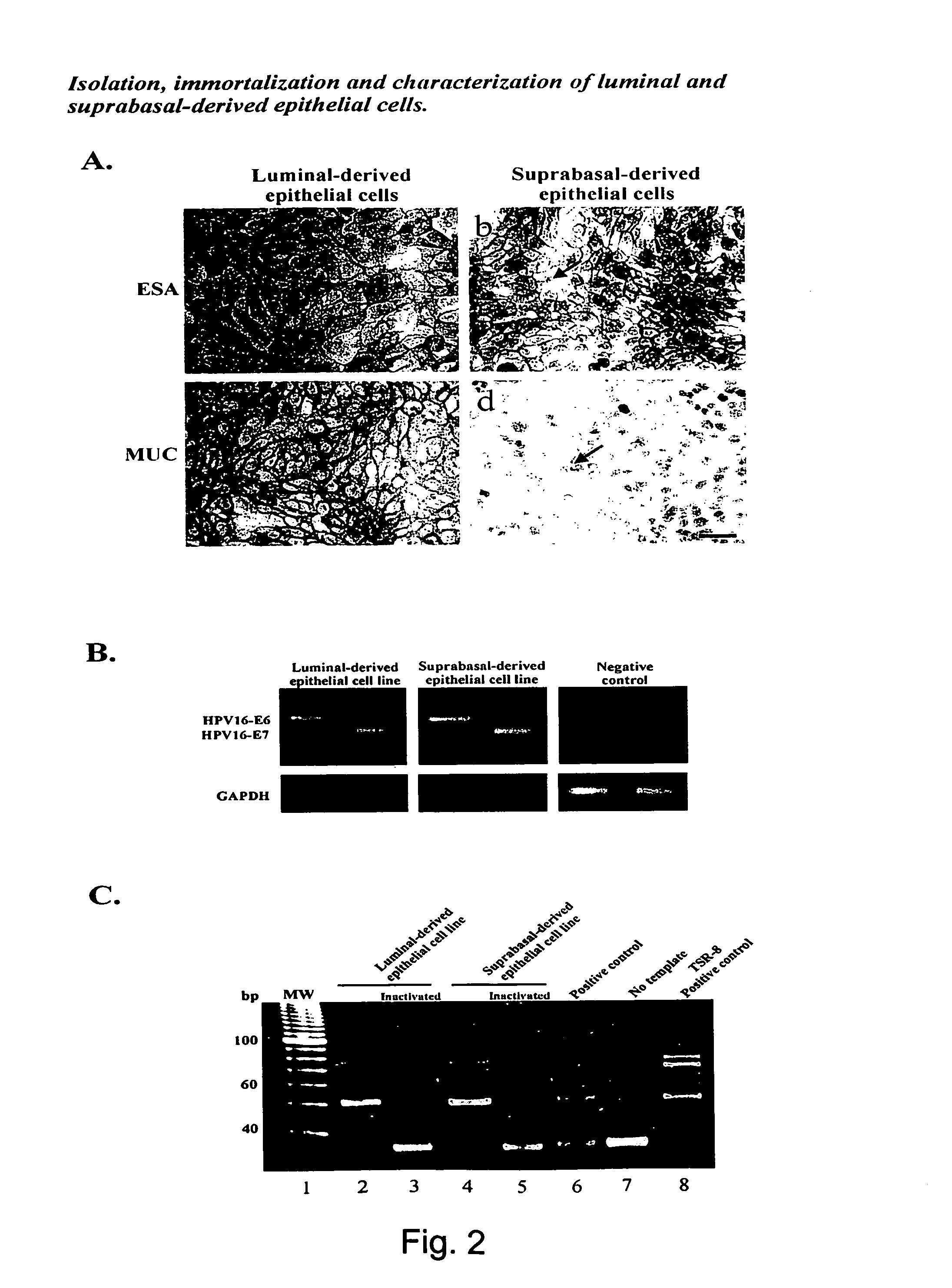 Suprabasal breast cell with stem cell properties