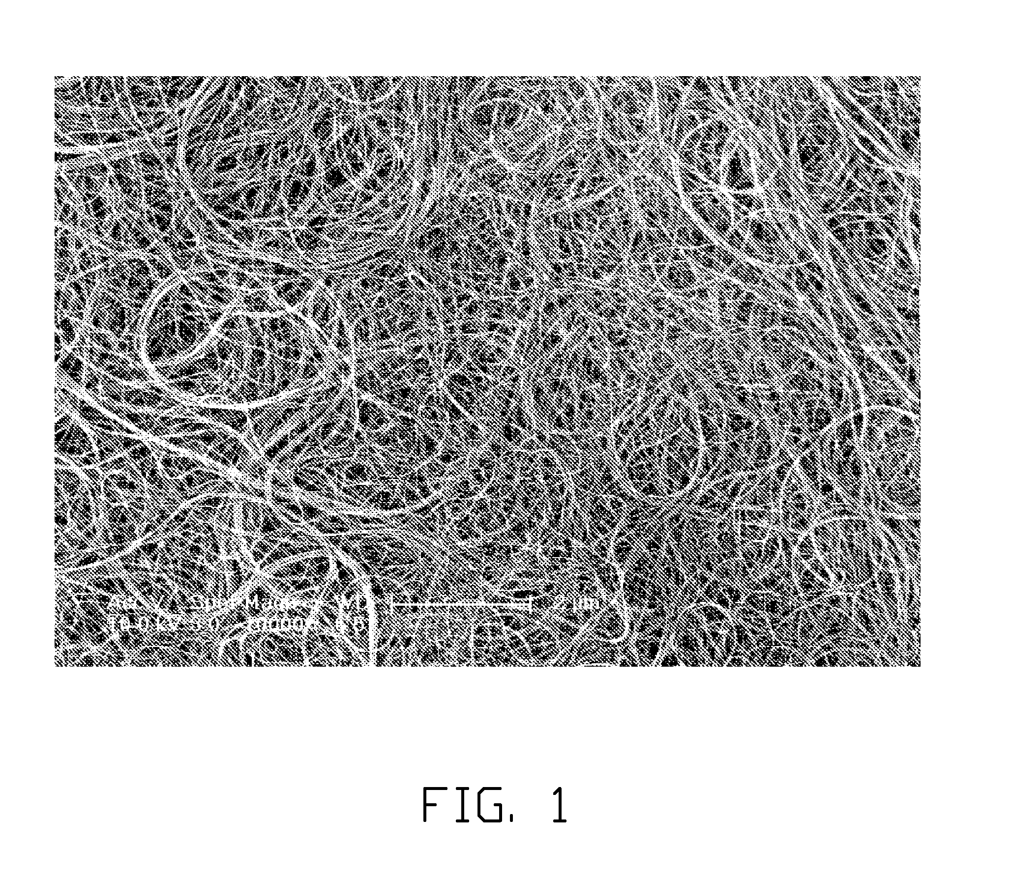 Carbon nanotube structure