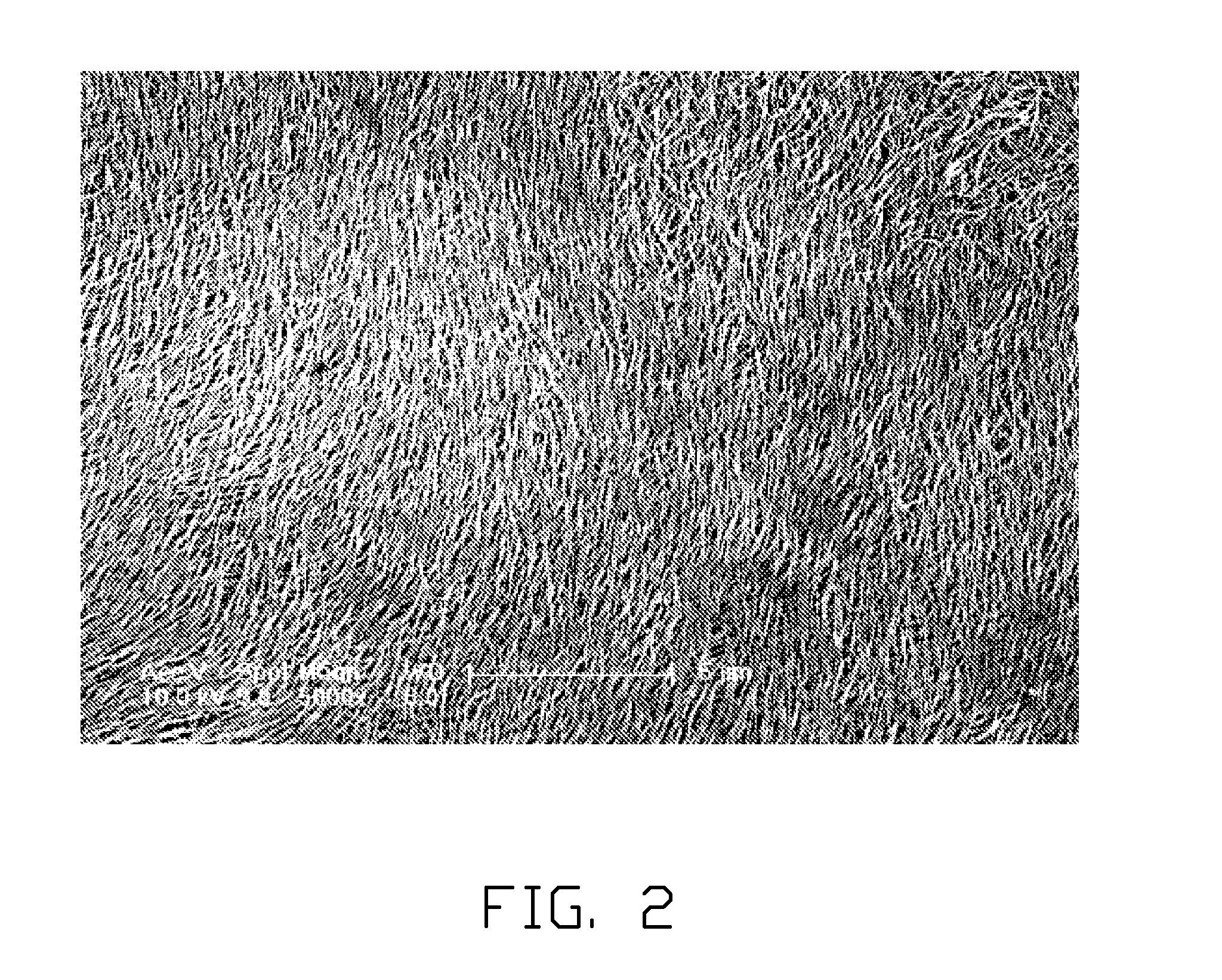 Carbon nanotube structure