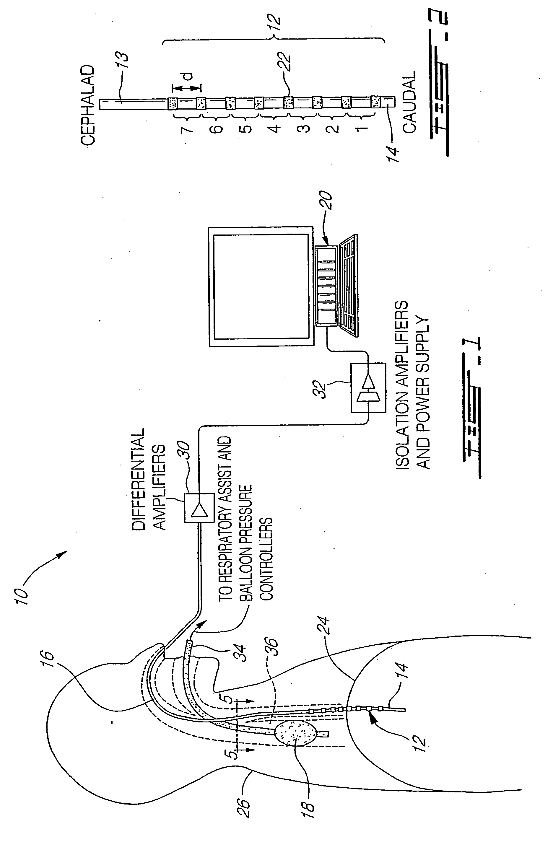 Myoelectrically activated respiratory leak sealing