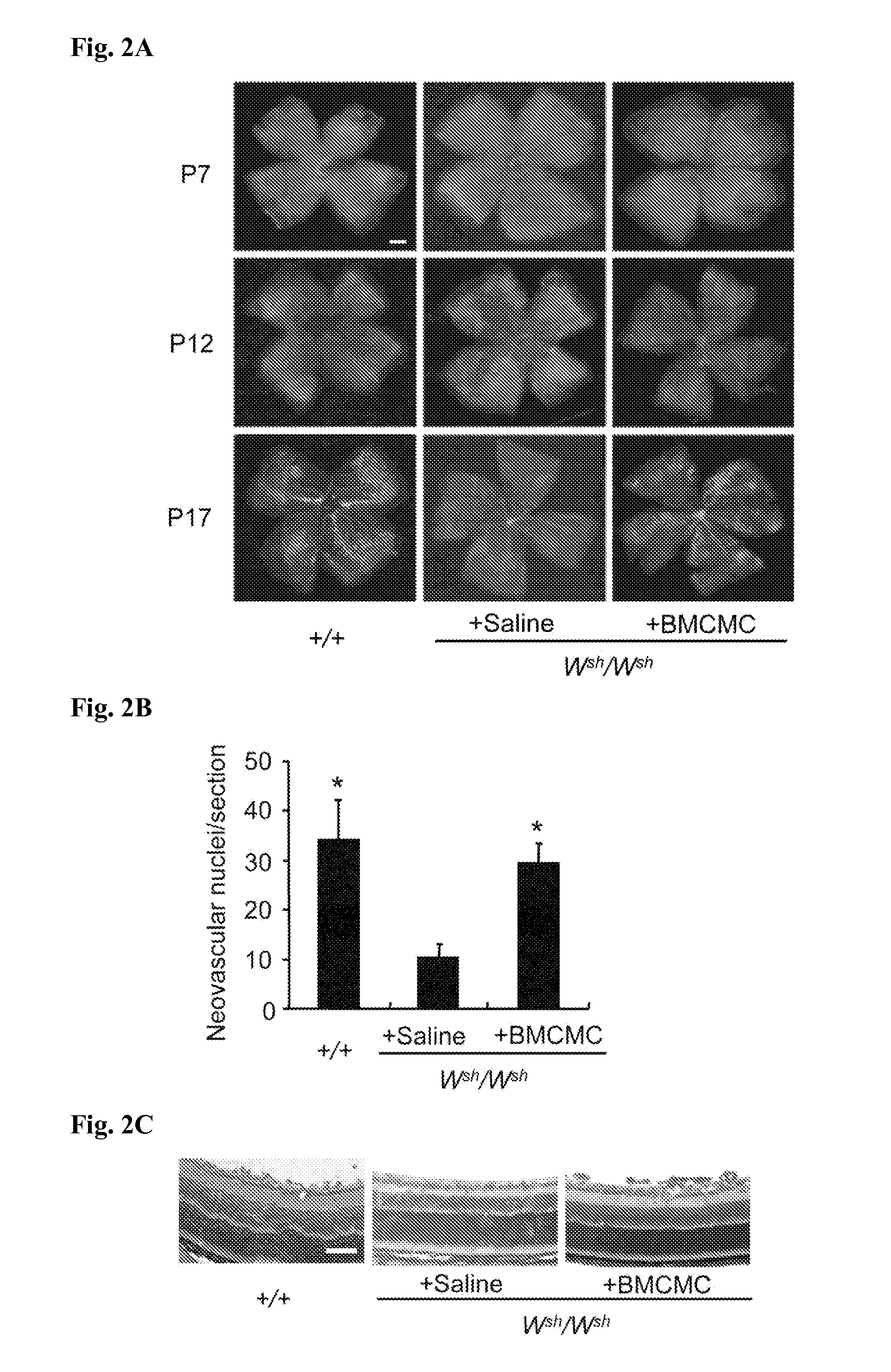 Therapeutic or prophylactic agent for retinopathy of prematurity, testing method for retinopathy of prematurity, and screening method for therapeutic or prophylactic substance for retinopathy of prematurity