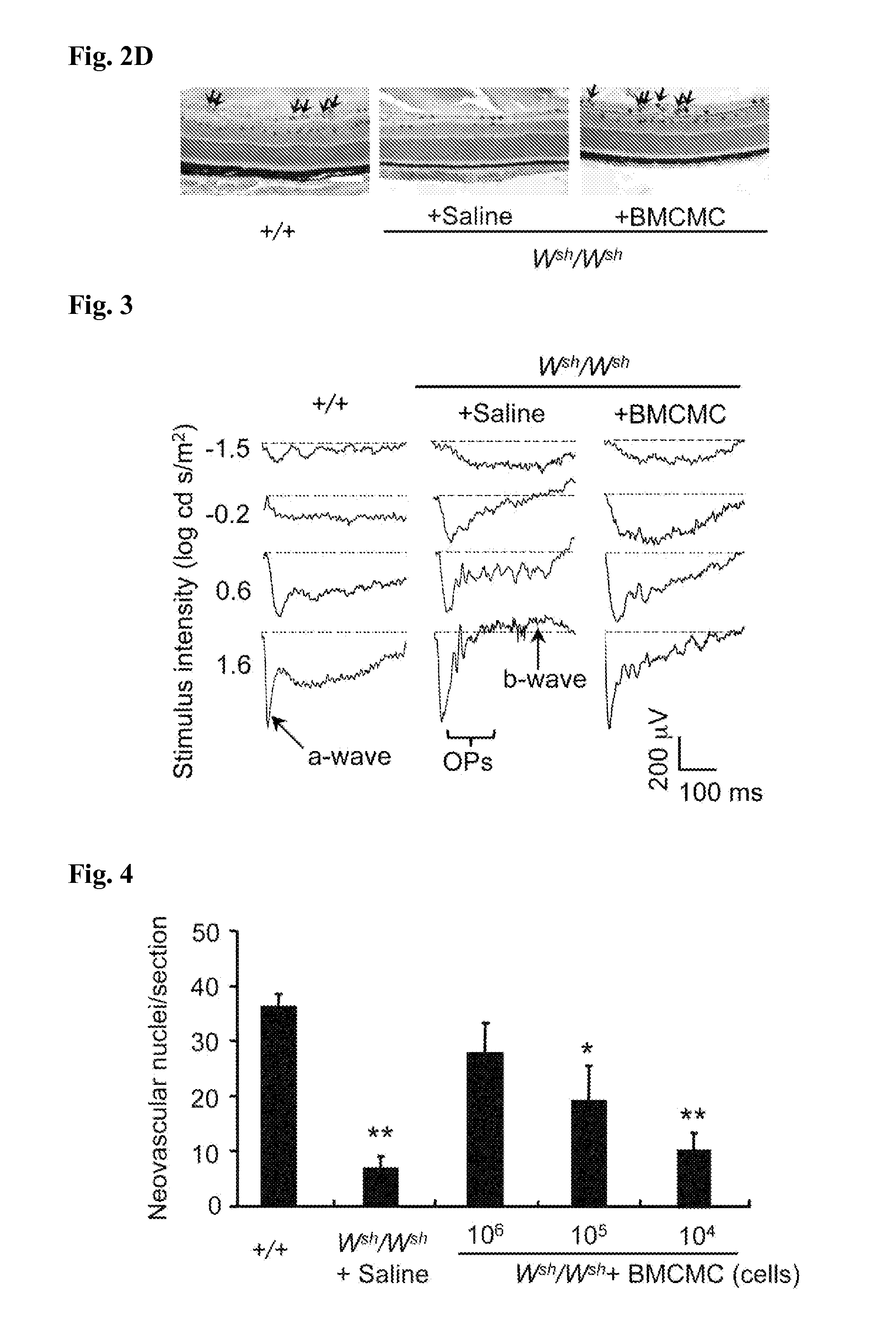 Therapeutic or prophylactic agent for retinopathy of prematurity, testing method for retinopathy of prematurity, and screening method for therapeutic or prophylactic substance for retinopathy of prematurity