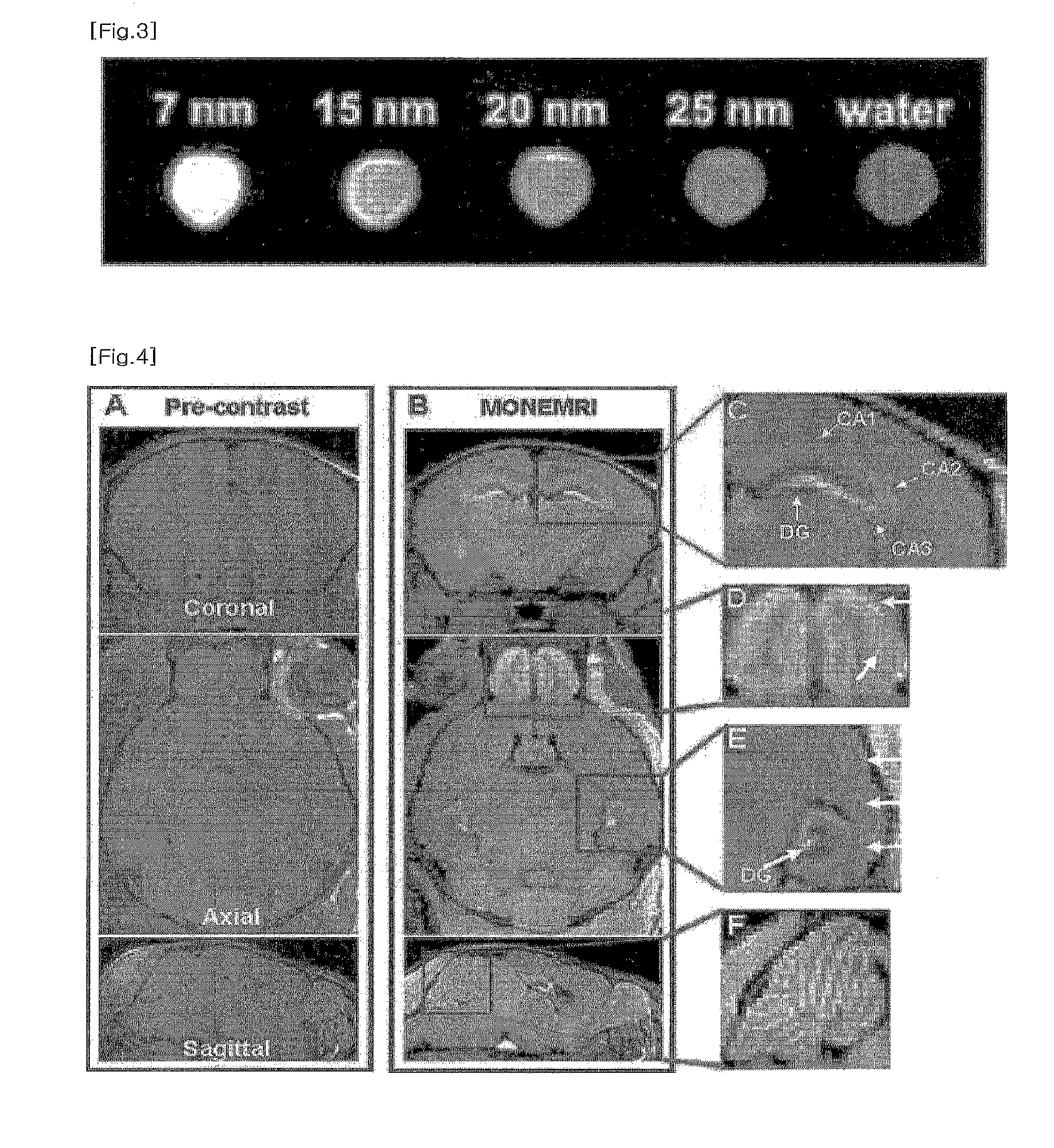 MRI t1 contrasting agent comprising manganese oxide nanoparticle