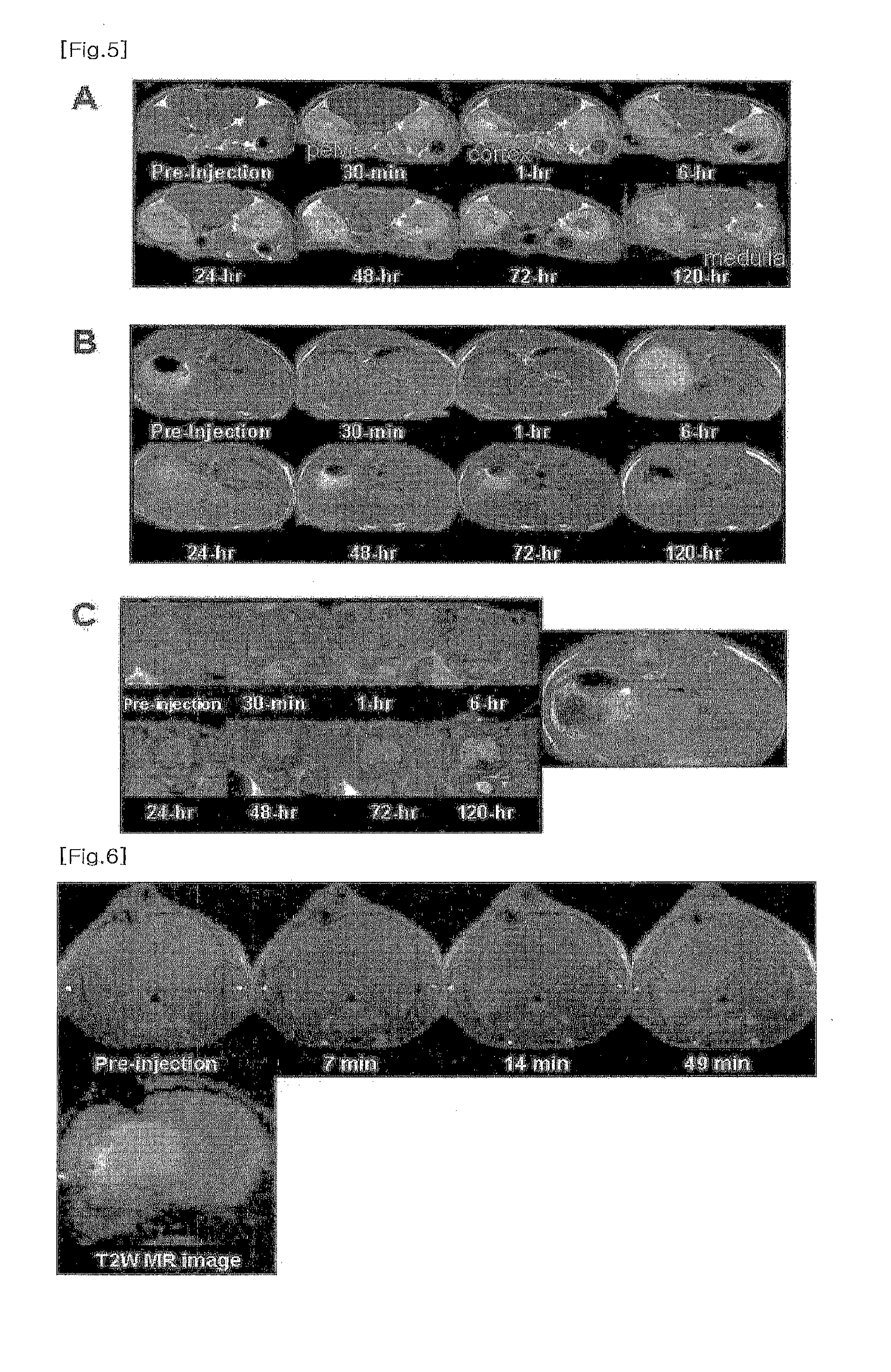 MRI t1 contrasting agent comprising manganese oxide nanoparticle