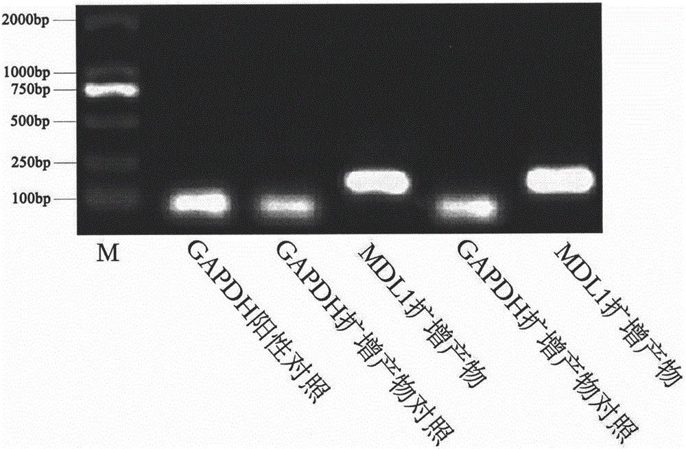 New gene MDL1, and quantitative detection method thereof