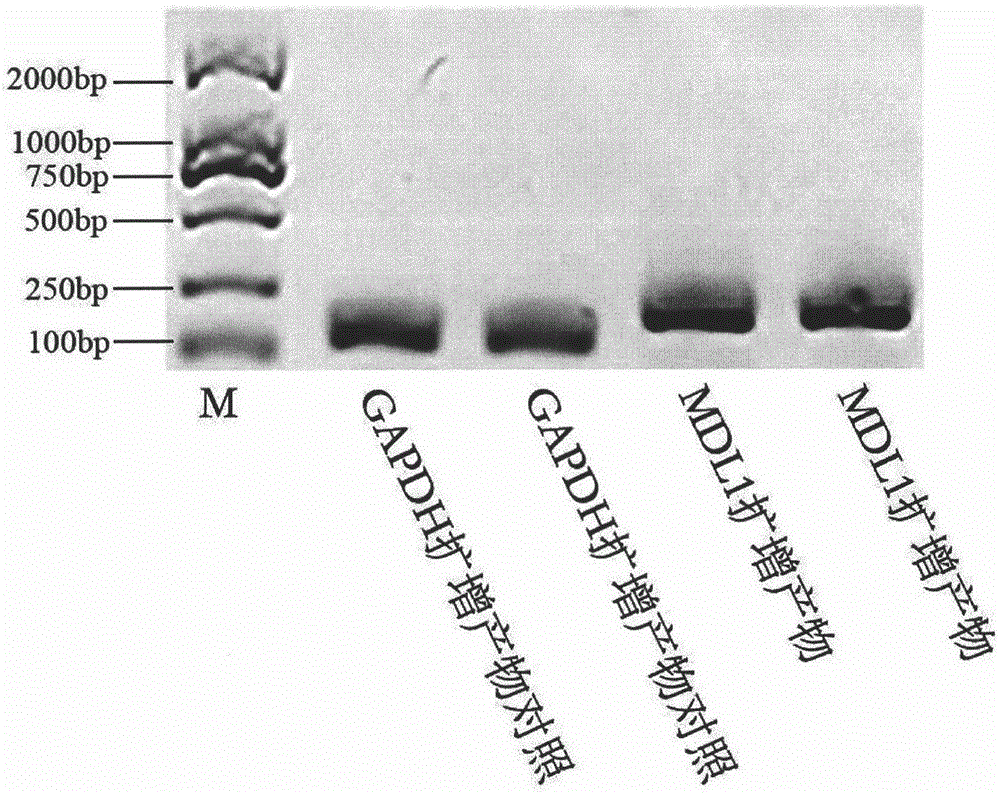 New gene MDL1, and quantitative detection method thereof