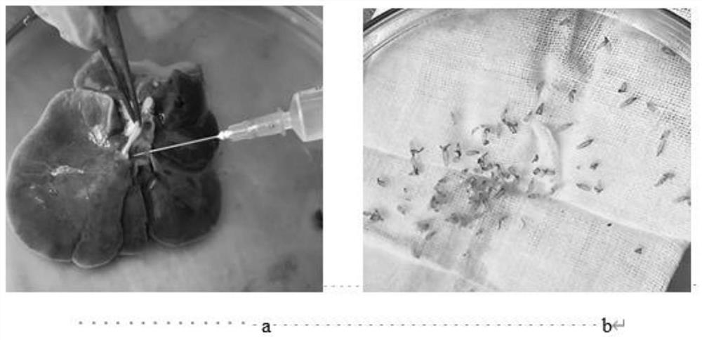 Application of nanogold rod in detection of serum circulating antigen through clonorchis sinensis specific antibody