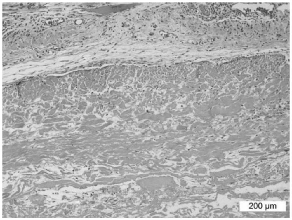 Soft tissue repair material and its preparation method and application