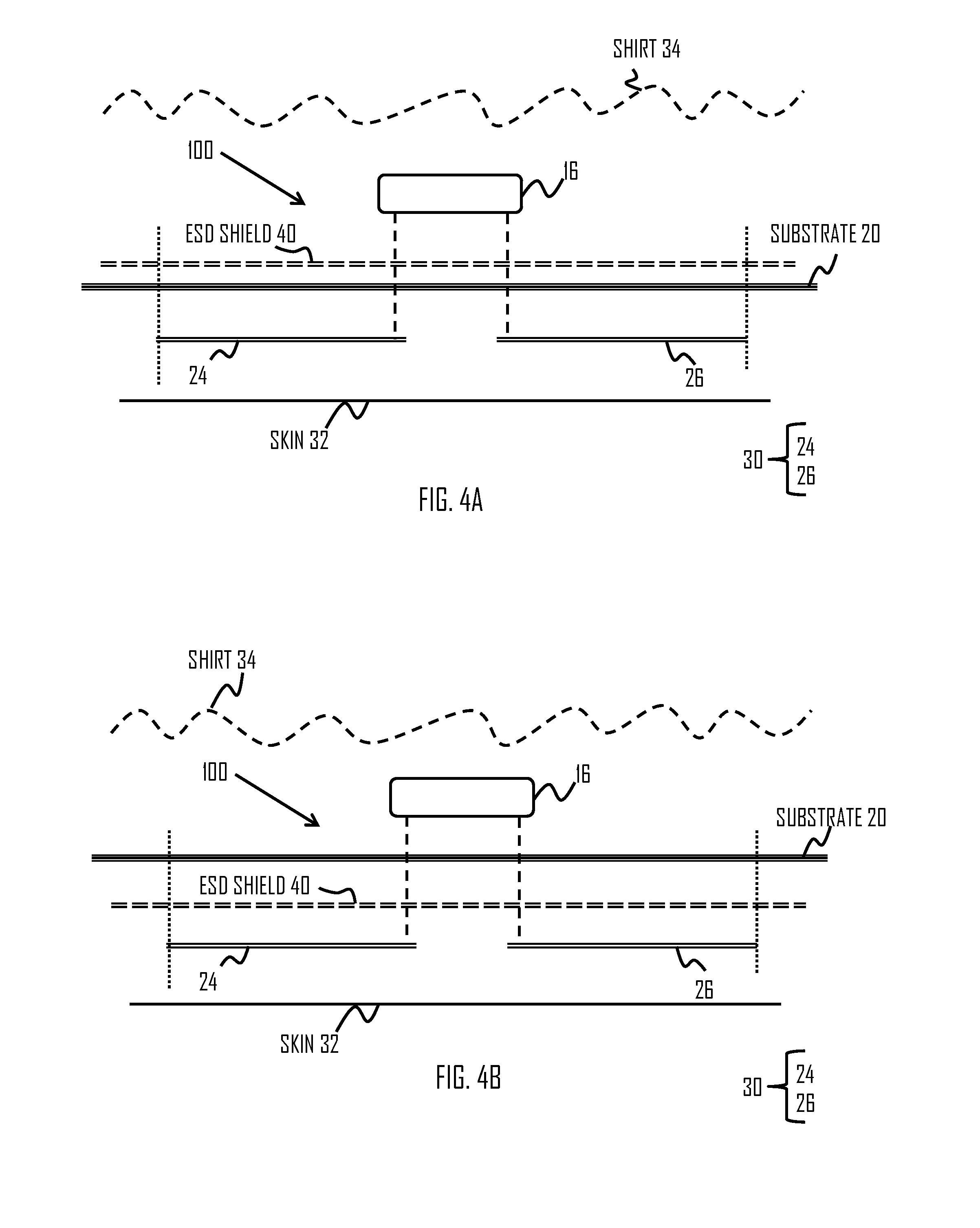 Heart activity sensor structure