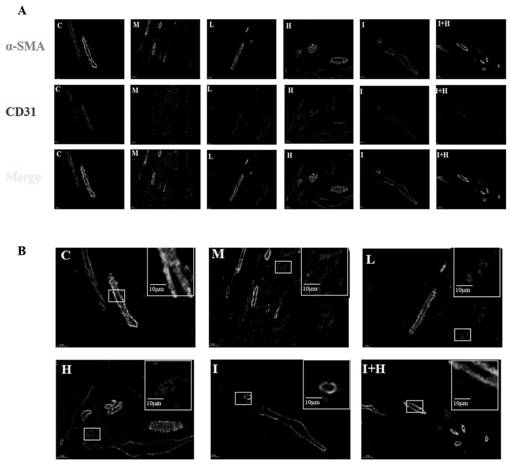 Use of total saponins of panax japonicas in preparing medicine for treating rheumatoid arthritis angiogenesis