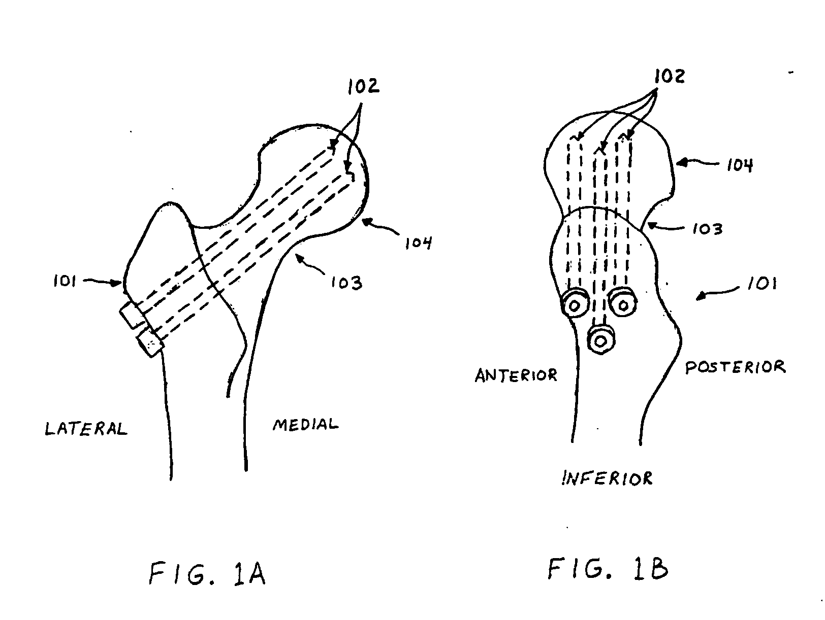 Enhanced graphic features for computer assisted surgery system