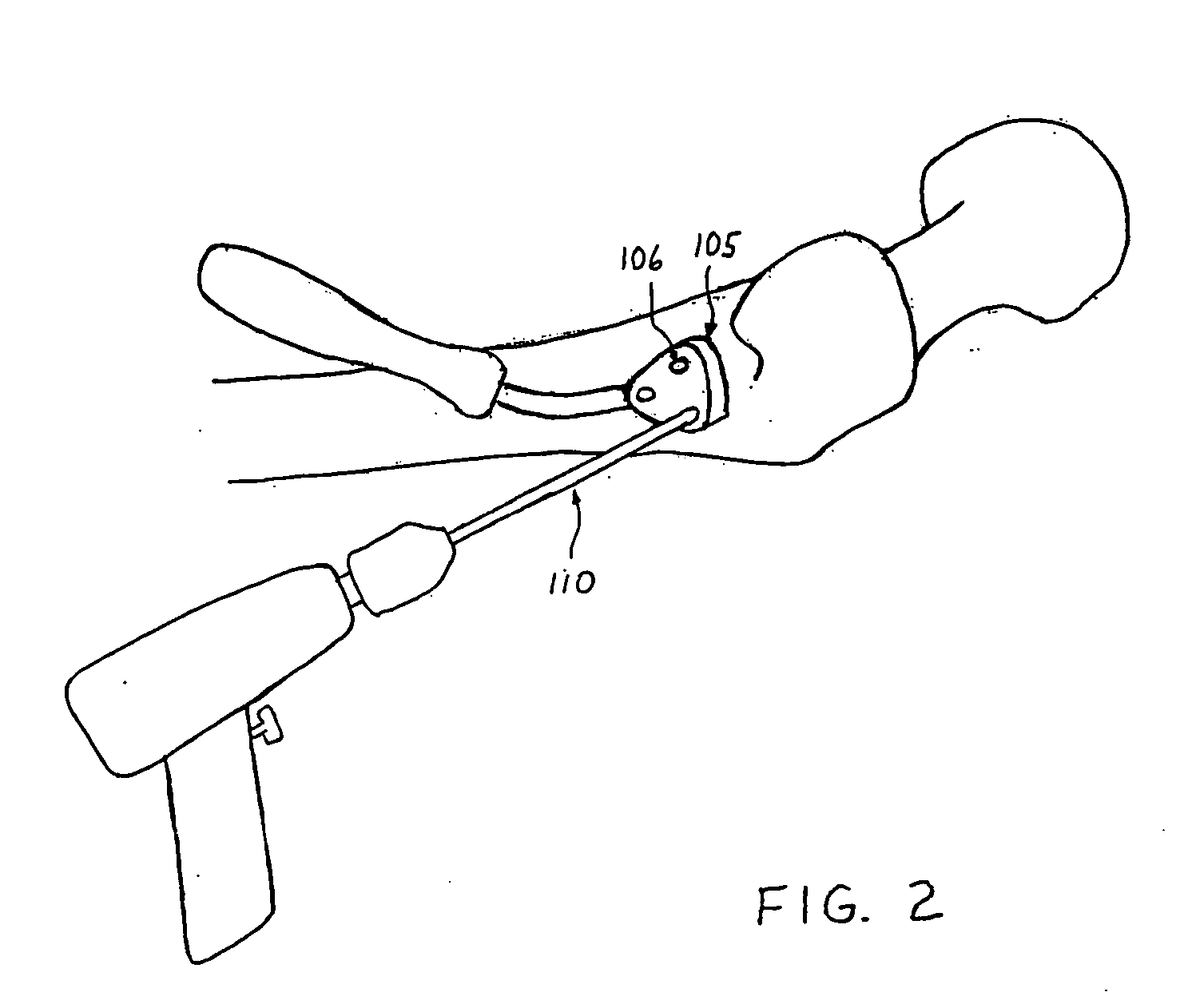 Enhanced graphic features for computer assisted surgery system