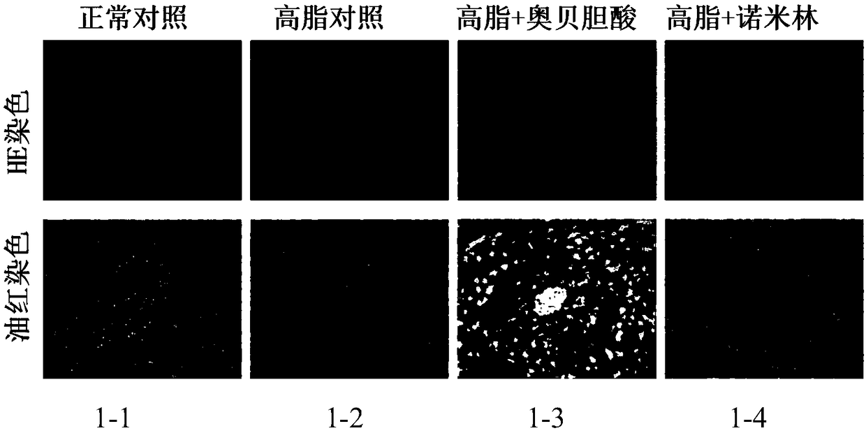 Application of nometin in preparation of drug for ameliorating liver injury caused by cholestasis and metabolic diseases