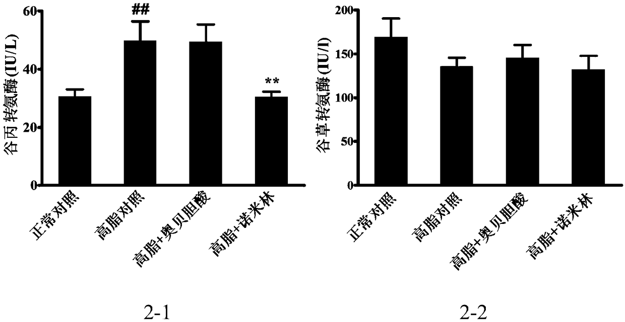 Application of nometin in preparation of drug for ameliorating liver injury caused by cholestasis and metabolic diseases