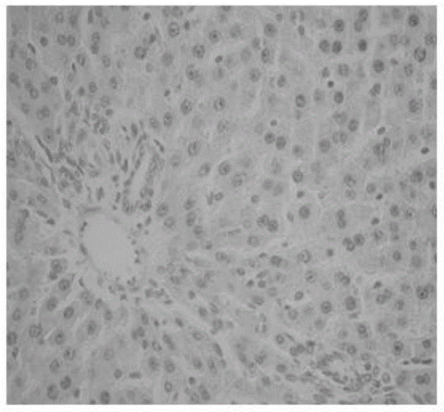 Novel application of acanthopanax polysaccharide