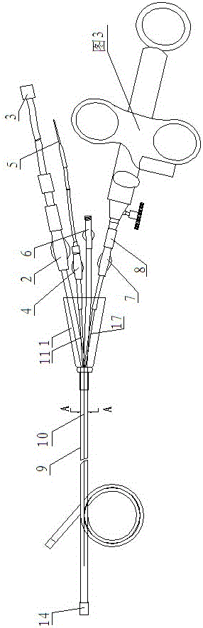 Lithotripsy device for soft ureteral channel