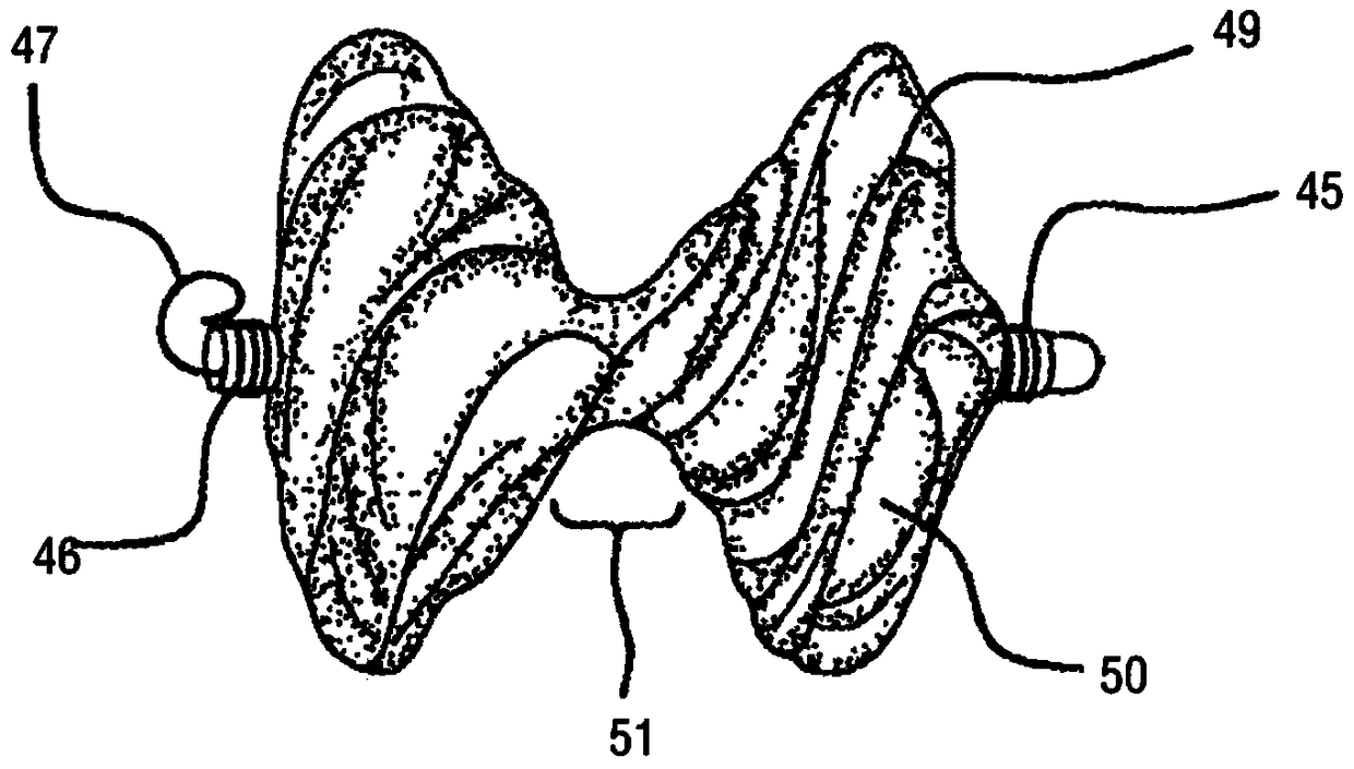 Occluder and method of making the same