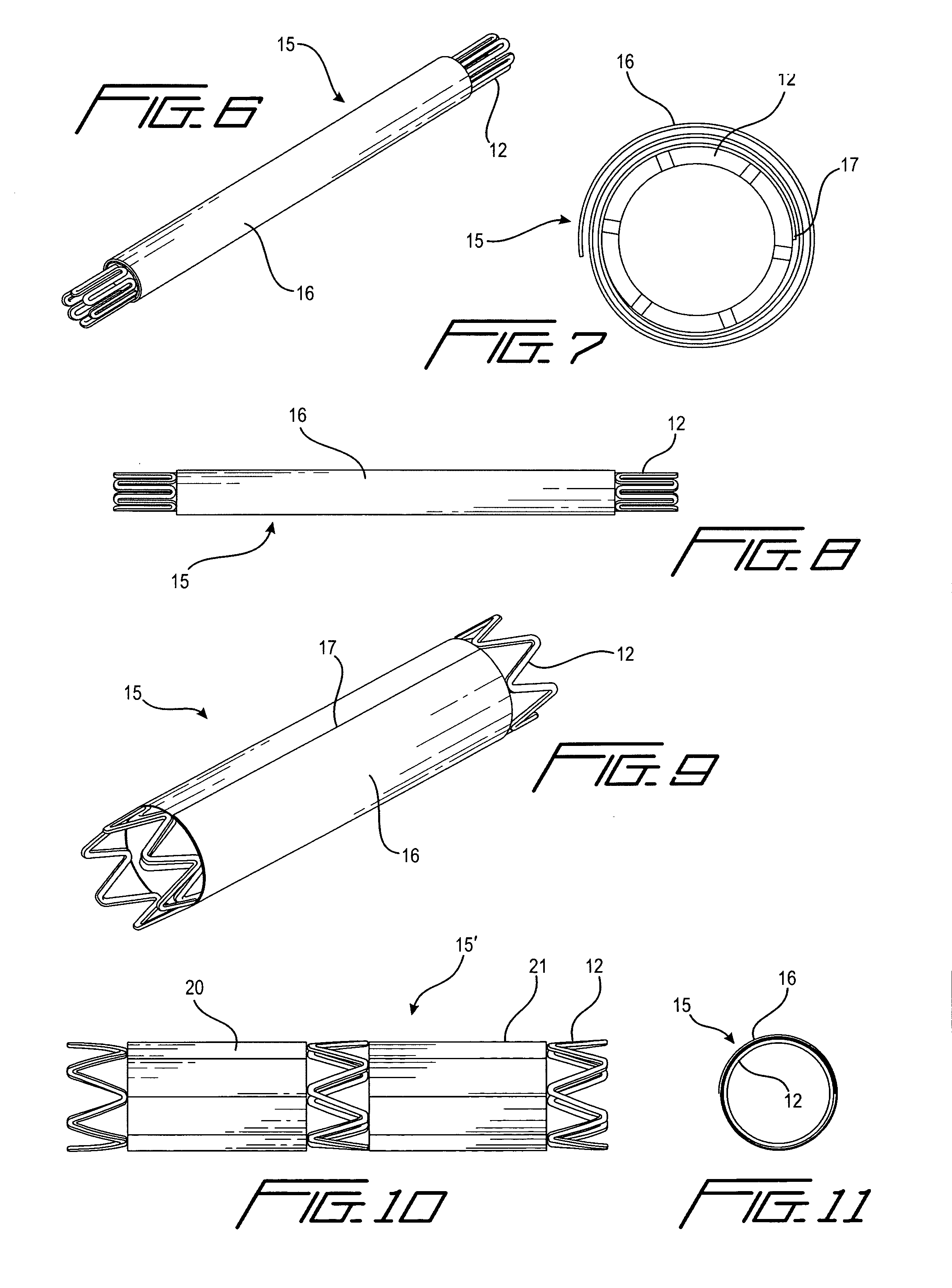 Medical stent and devices for localized treatment of disease