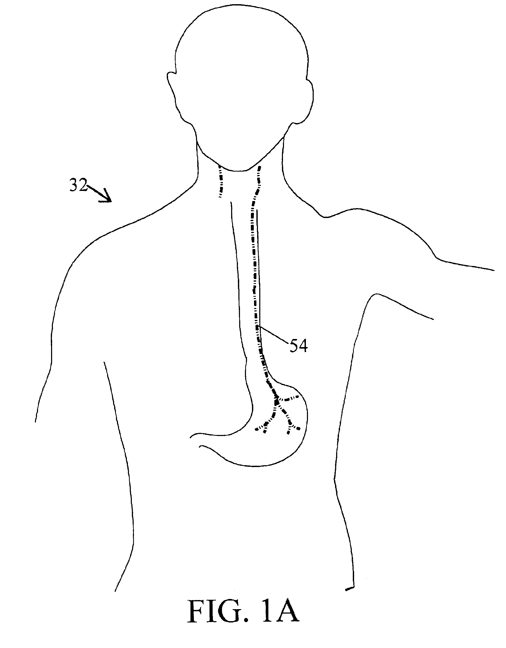 External pulse generator for adjunct (add-on) treatment of obesity, eating disorders, neurological, neuropsychiatric, and urological disorders