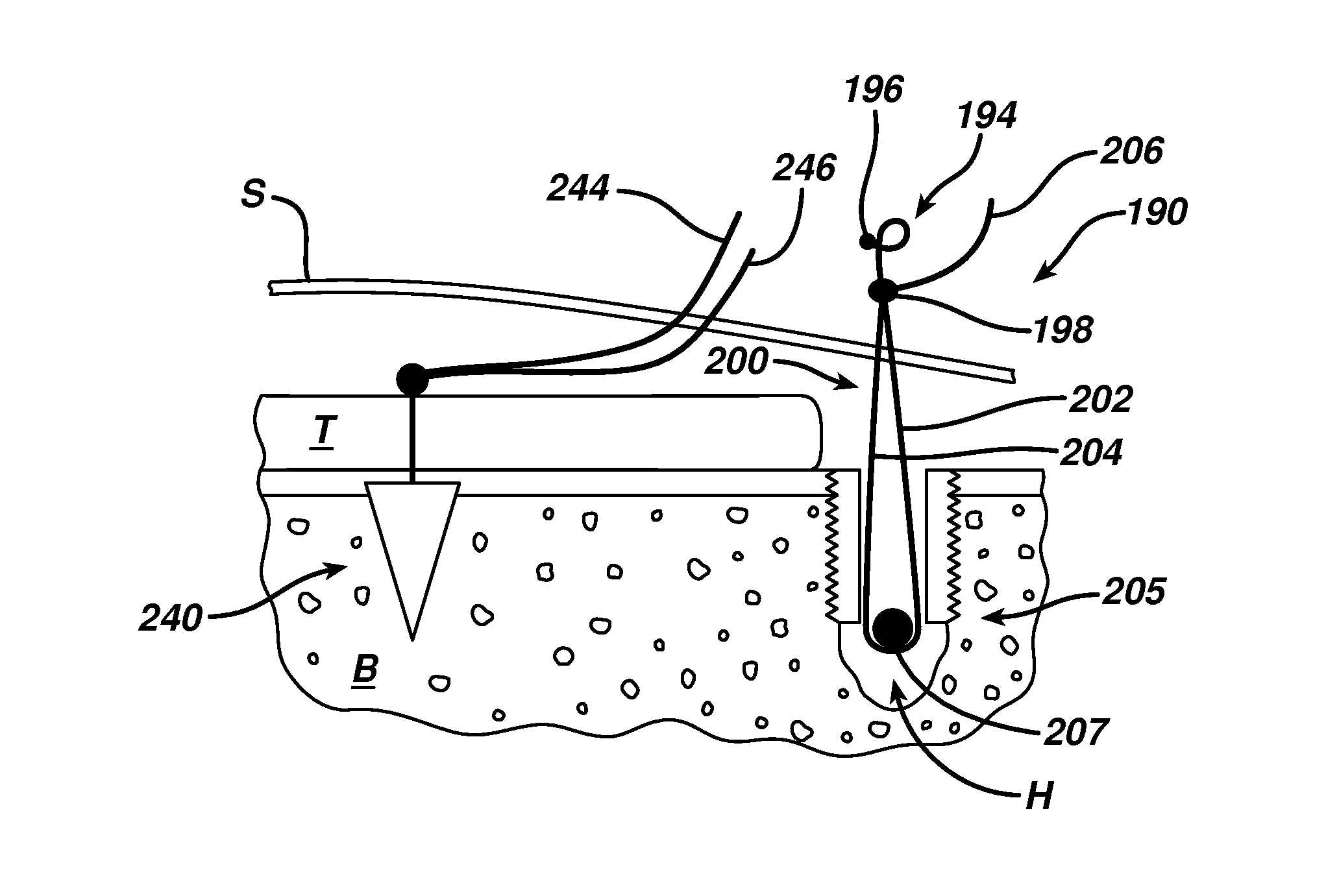 Surgical filament snare assemblies